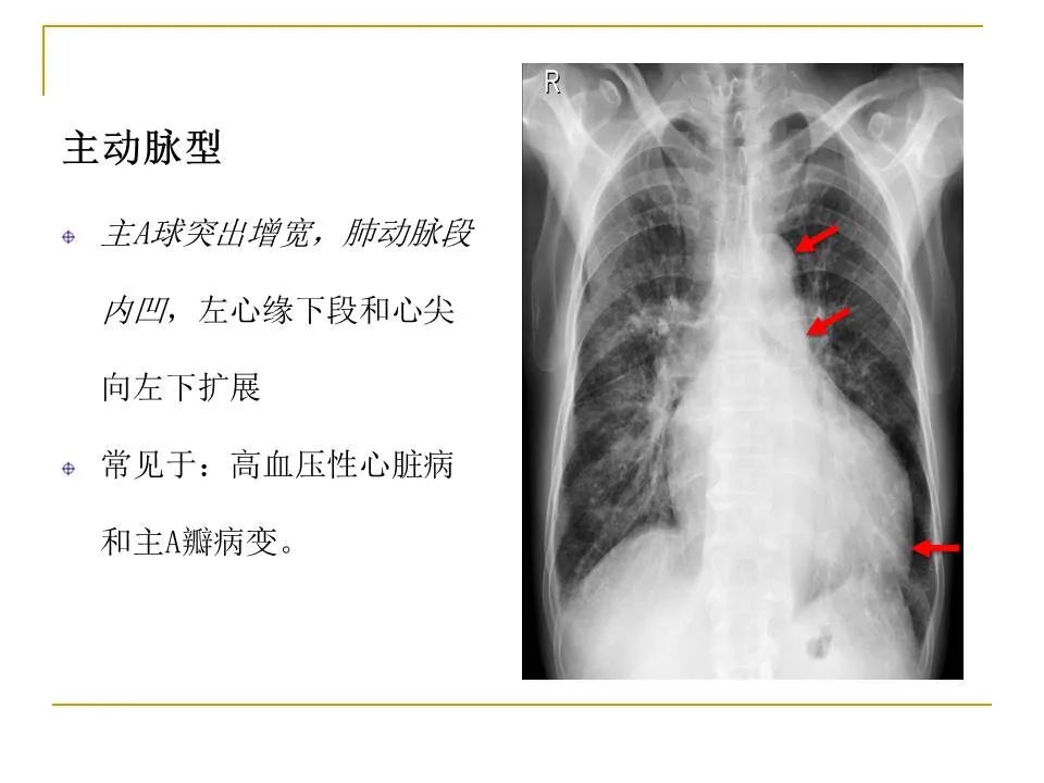 影像PPT - 【PPT】临床专业住院医师结业技能考核-83