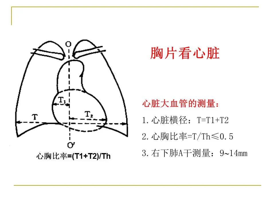 影像PPT - 【PPT】临床专业住院医师结业技能考核-81