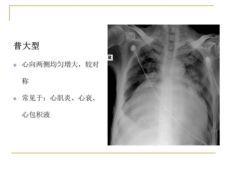 影像PPT - 【PPT】临床专业住院医师结业技能考核-84