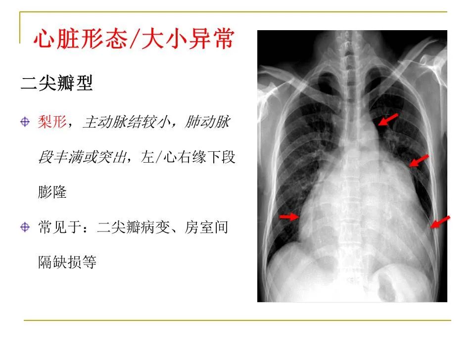 影像PPT - 【PPT】临床专业住院医师结业技能考核-82