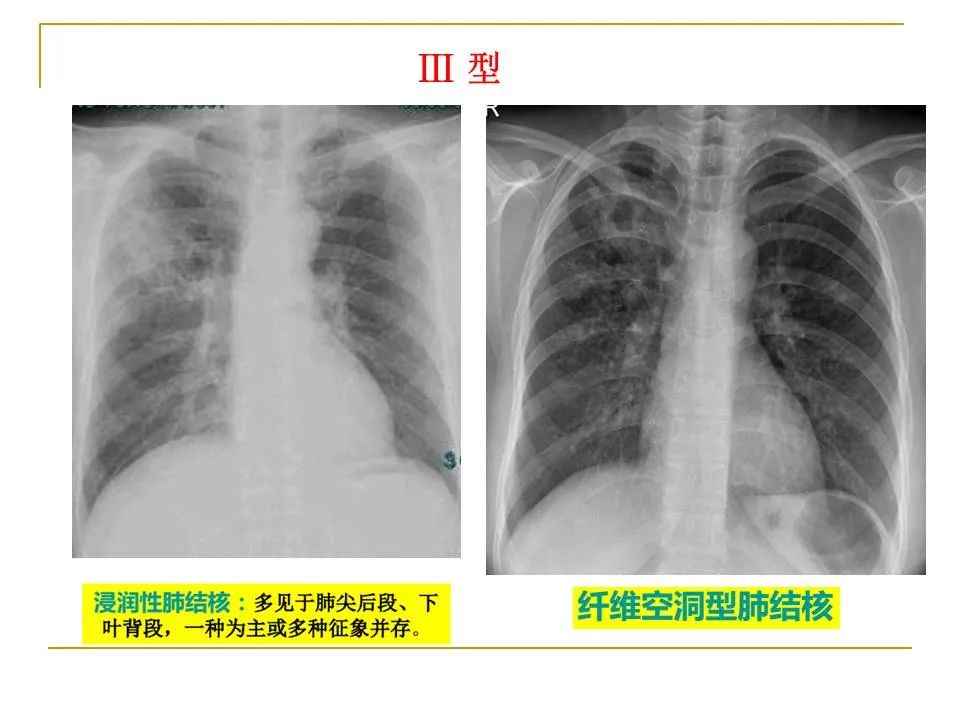 影像PPT - 【PPT】临床专业住院医师结业技能考核-76