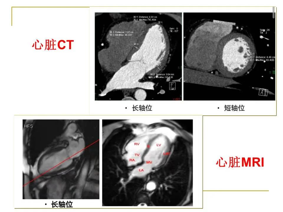 影像PPT - 【PPT】临床专业住院医师结业技能考核-85