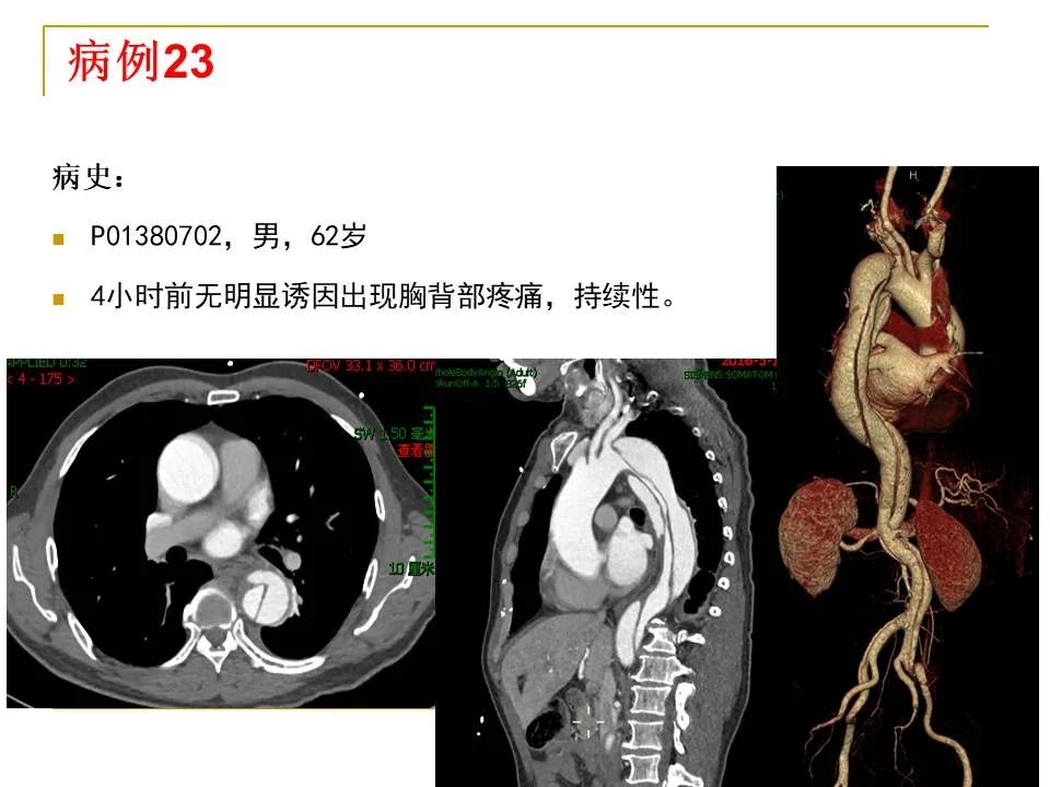 影像PPT - 【PPT】临床专业住院医师结业技能考核-86