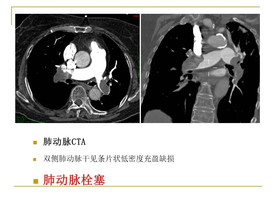 影像PPT - 【PPT】临床专业住院医师结业技能考核-92