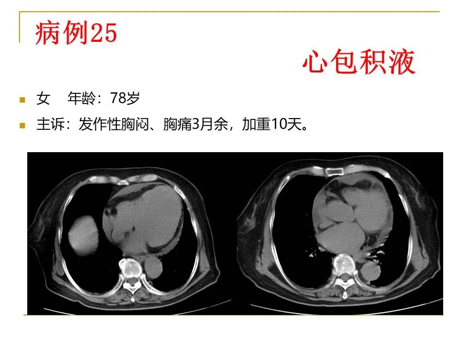 影像PPT - 【PPT】临床专业住院医师结业技能考核-94