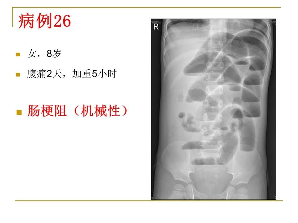 影像PPT - 【PPT】临床专业住院医师结业技能考核-96
