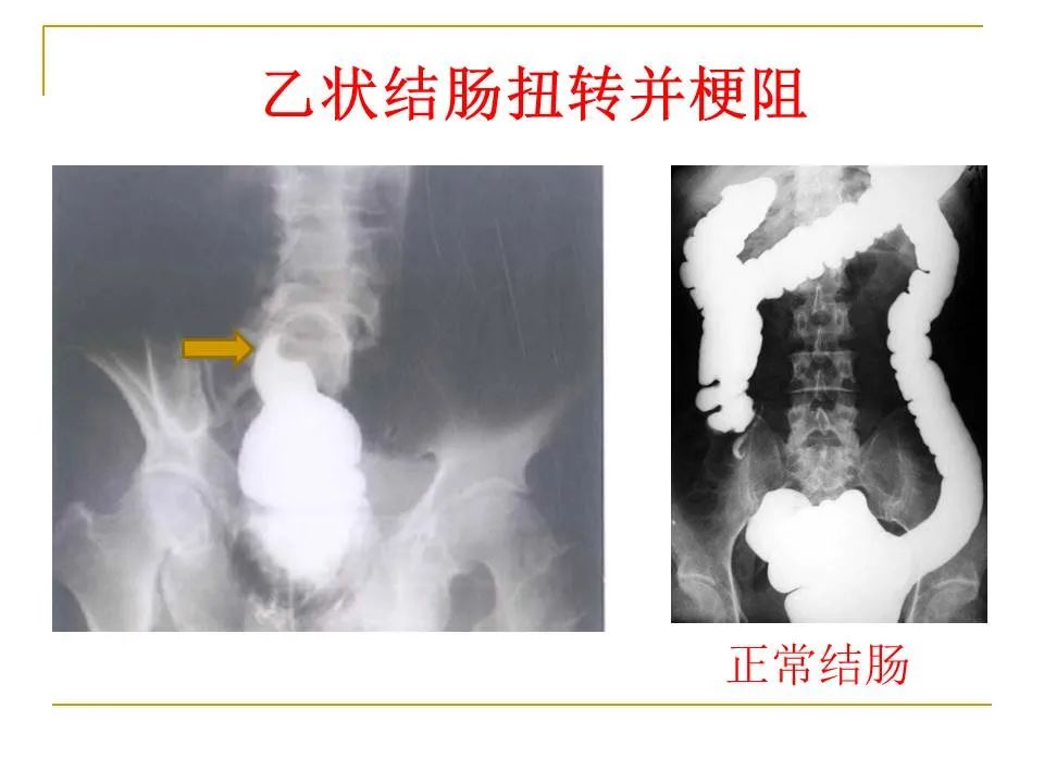 影像PPT - 【PPT】临床专业住院医师结业技能考核-97
