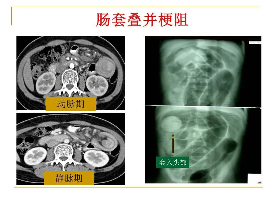 影像PPT - 【PPT】临床专业住院医师结业技能考核-98