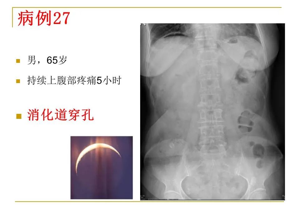 影像PPT - 【PPT】临床专业住院医师结业技能考核-99