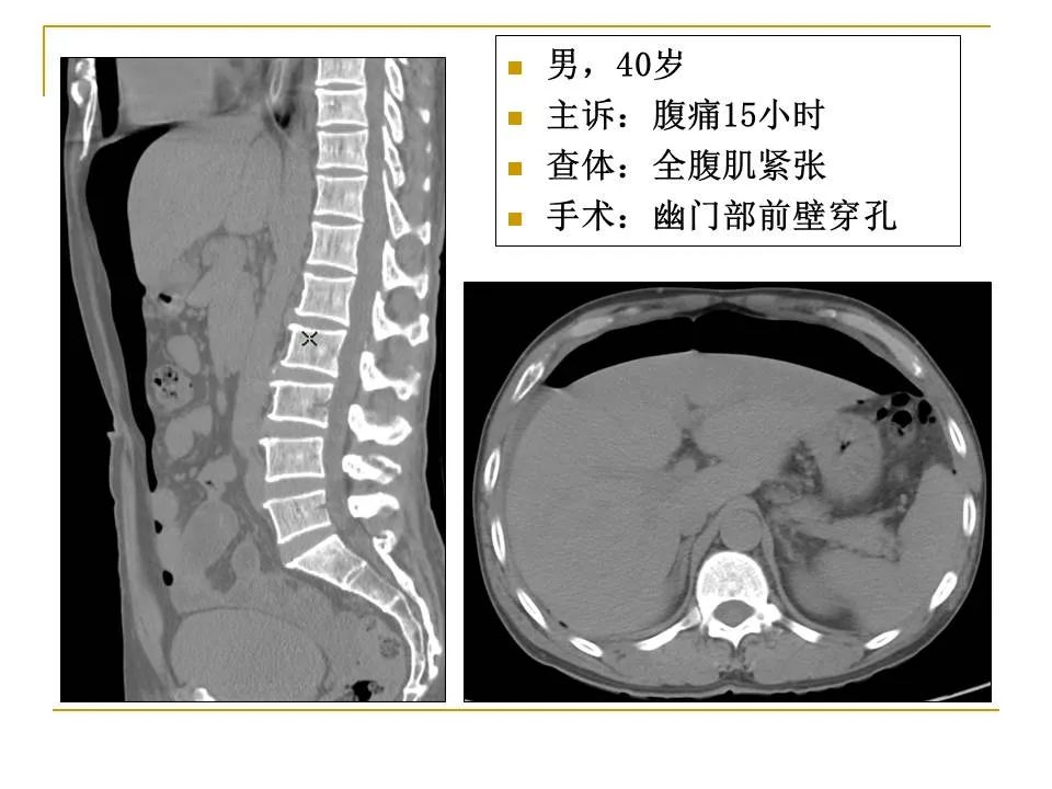 影像PPT - 【PPT】临床专业住院医师结业技能考核-101