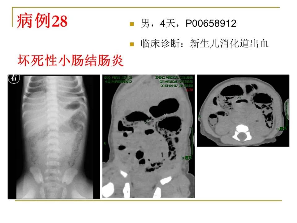 影像PPT - 【PPT】临床专业住院医师结业技能考核-102