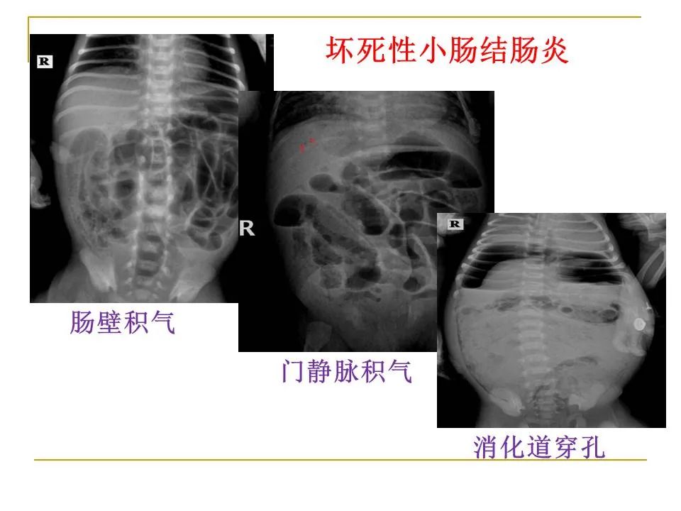 影像PPT - 【PPT】临床专业住院医师结业技能考核-103