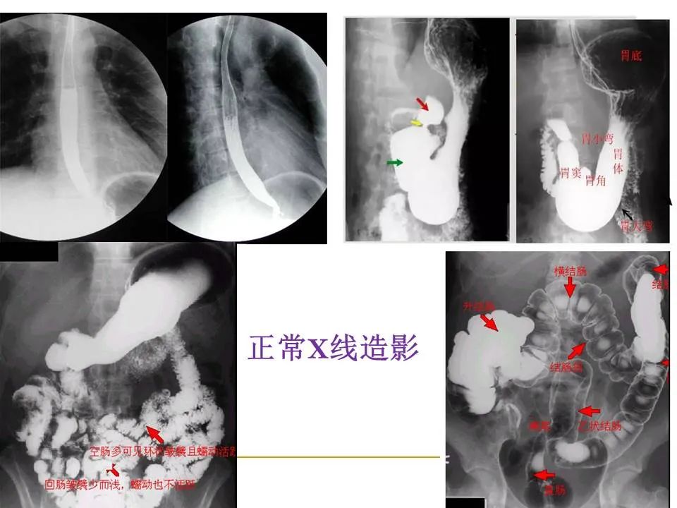 影像PPT - 【PPT】临床专业住院医师结业技能考核-104