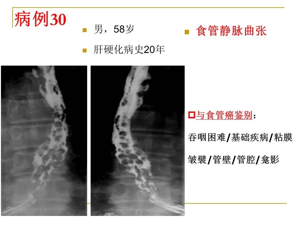 影像PPT - 【PPT】临床专业住院医师结业技能考核-106