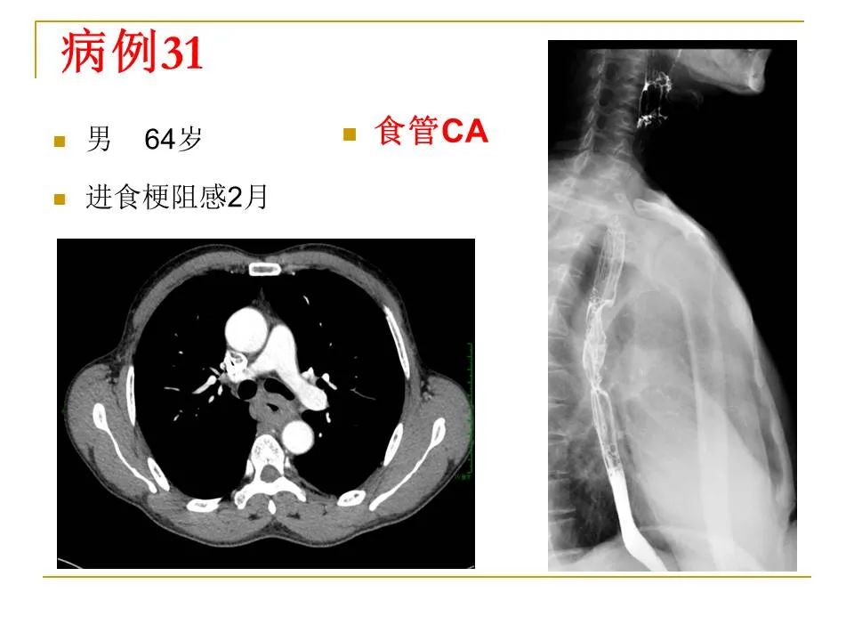 影像PPT - 【PPT】临床专业住院医师结业技能考核-107