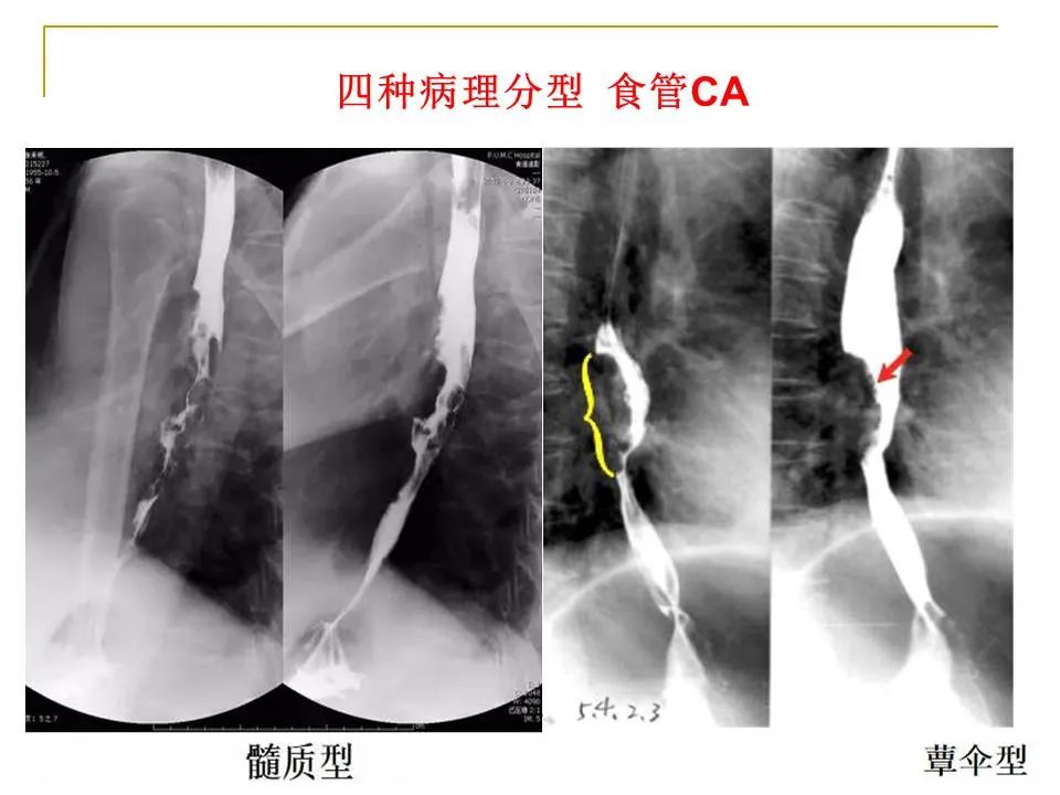影像PPT - 【PPT】临床专业住院医师结业技能考核-108