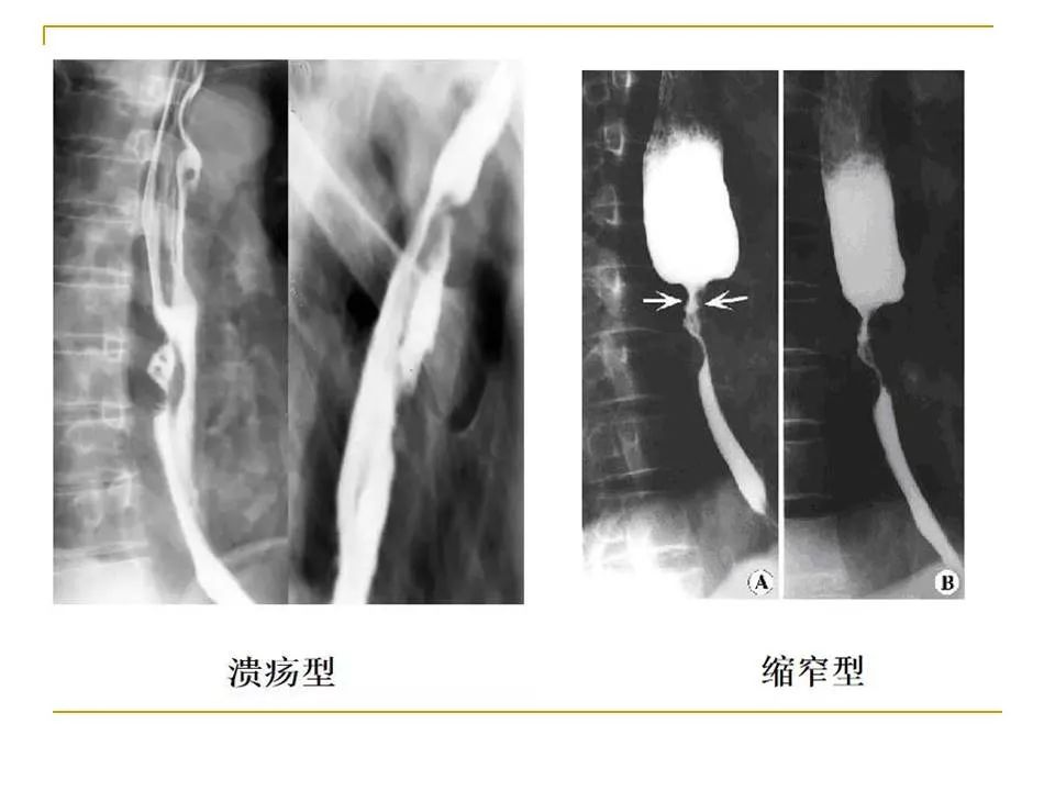 影像PPT - 【PPT】临床专业住院医师结业技能考核-109