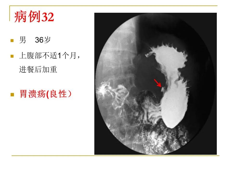 影像PPT - 【PPT】临床专业住院医师结业技能考核-110