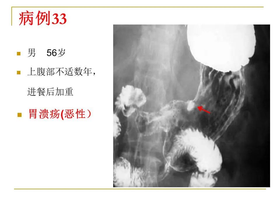 影像PPT - 【PPT】临床专业住院医师结业技能考核-111