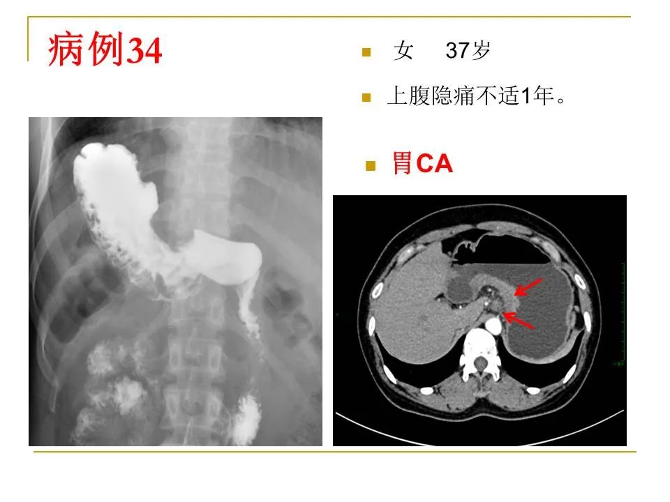 影像PPT - 【PPT】临床专业住院医师结业技能考核-113