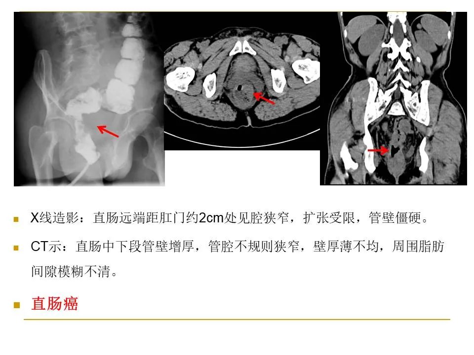 影像PPT - 【PPT】临床专业住院医师结业技能考核-115