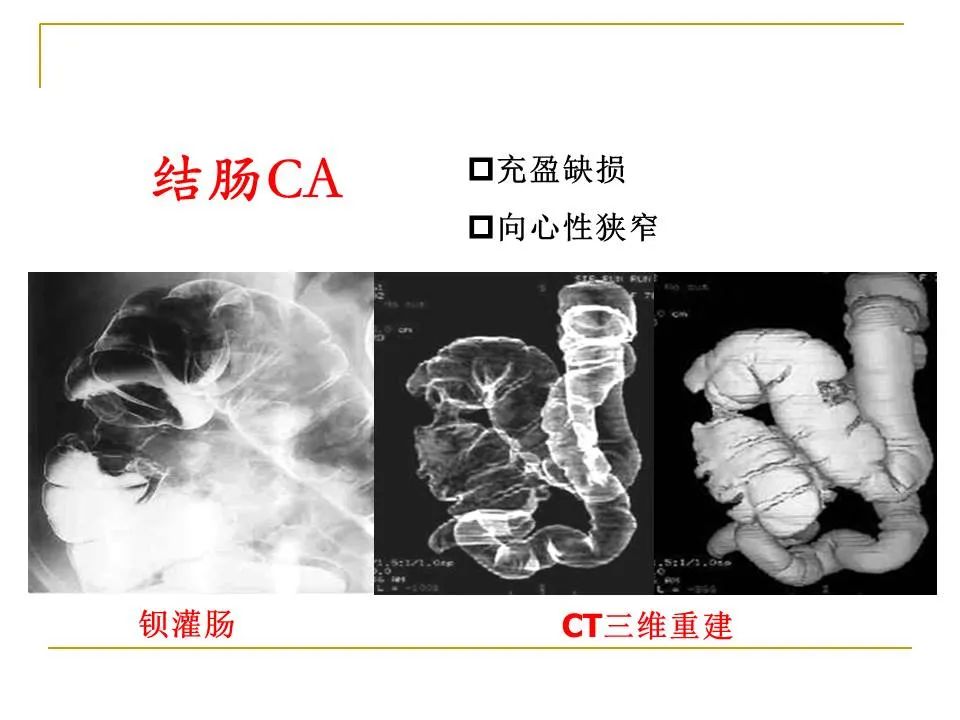 影像PPT - 【PPT】临床专业住院医师结业技能考核-116