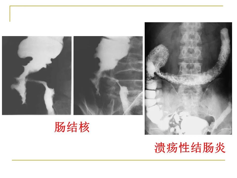 影像PPT - 【PPT】临床专业住院医师结业技能考核-117