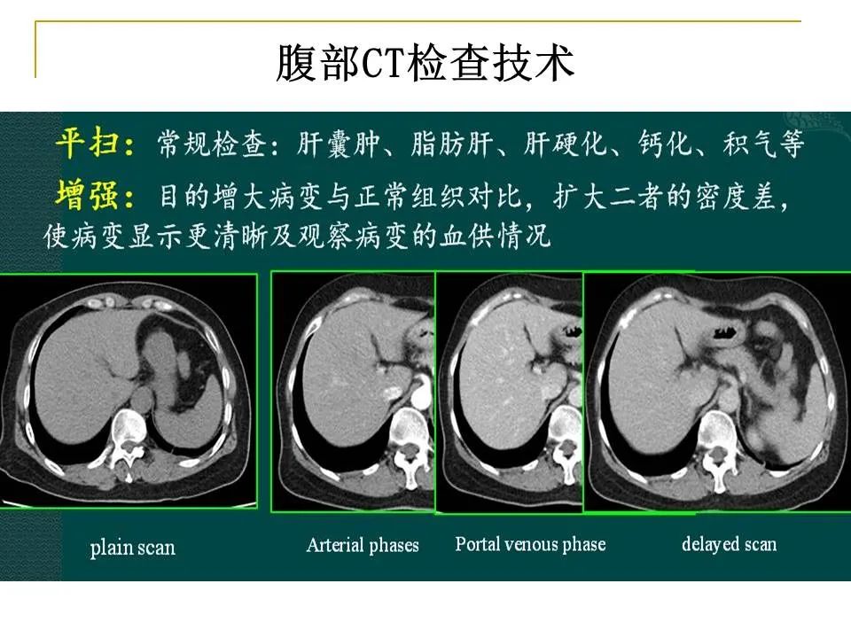 影像PPT - 【PPT】临床专业住院医师结业技能考核-118