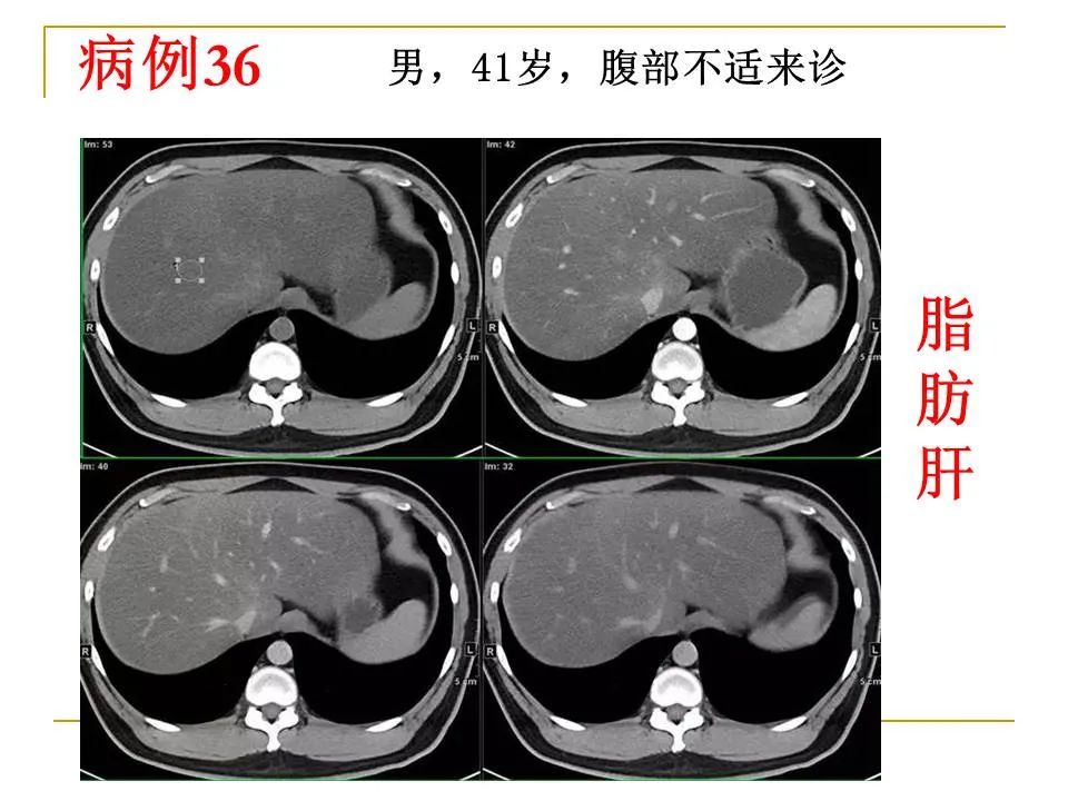 影像PPT - 【PPT】临床专业住院医师结业技能考核-119