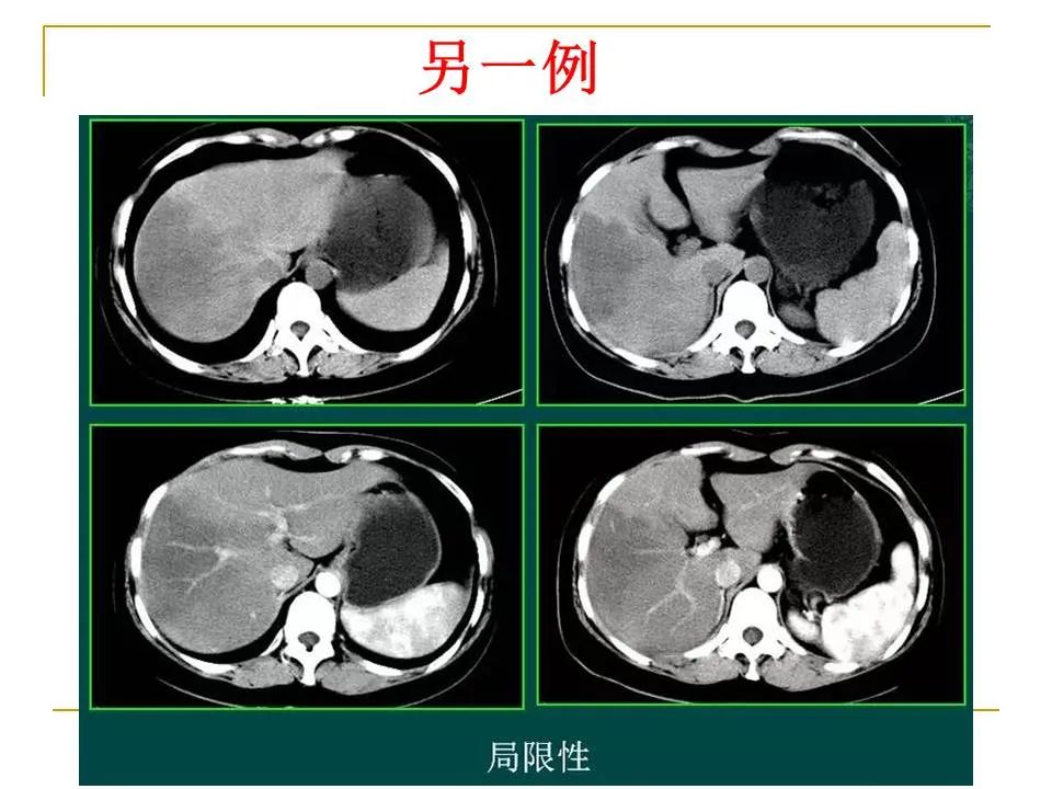 影像PPT - 【PPT】临床专业住院医师结业技能考核-120