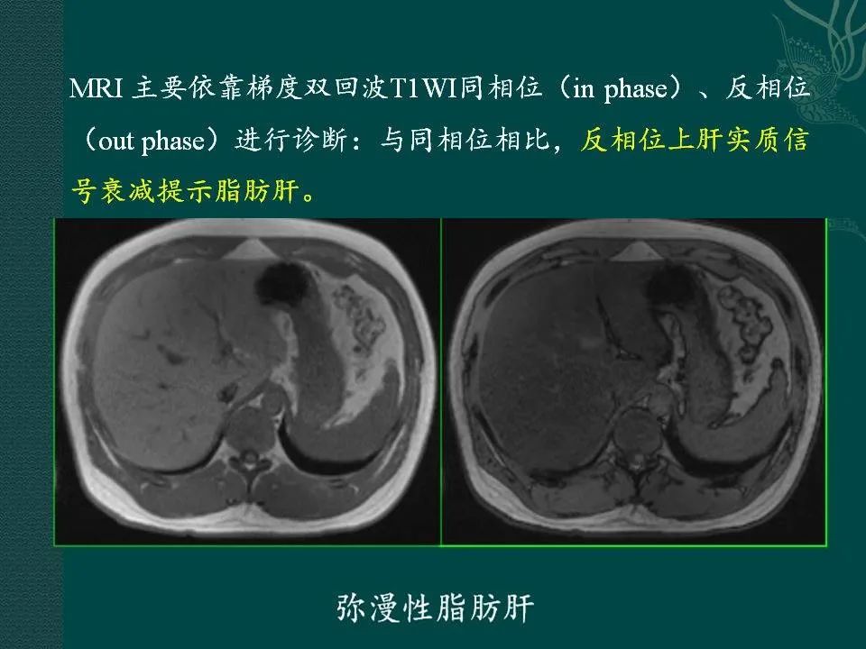影像PPT - 【PPT】临床专业住院医师结业技能考核-121