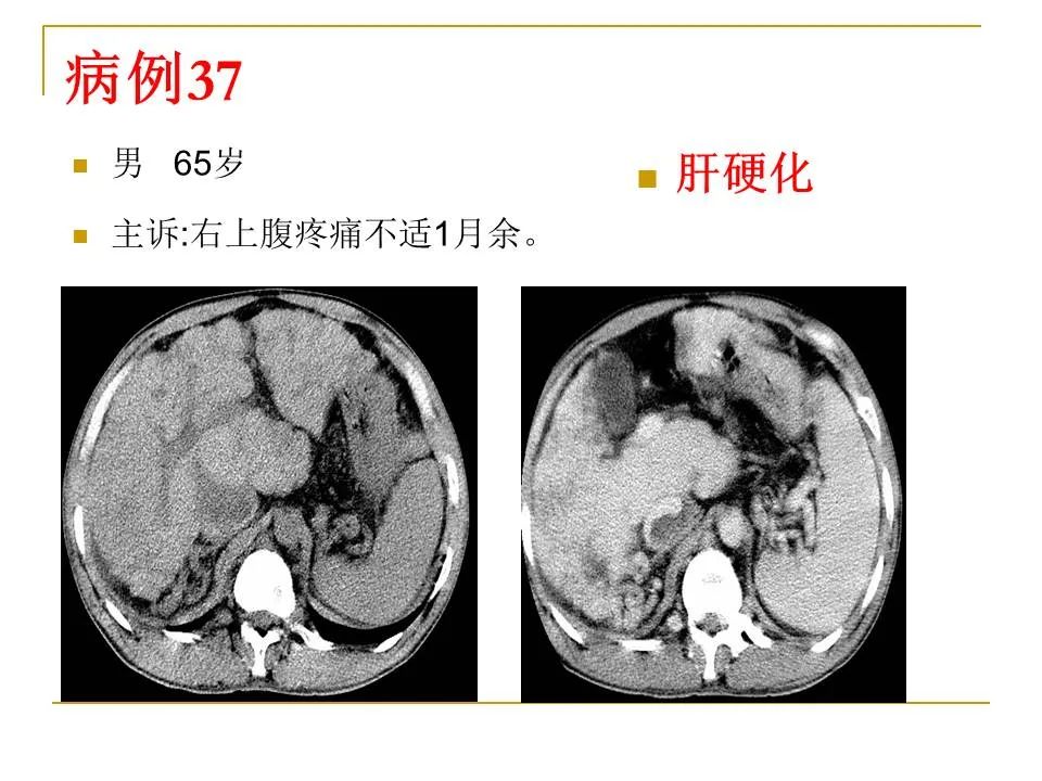 影像PPT - 【PPT】临床专业住院医师结业技能考核-122