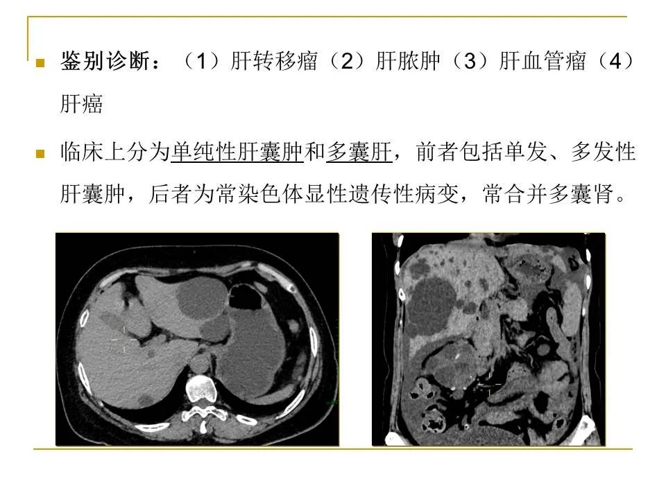 影像PPT - 【PPT】临床专业住院医师结业技能考核-125