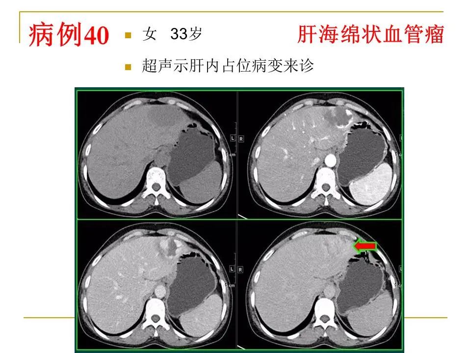 影像PPT - 【PPT】临床专业住院医师结业技能考核-129