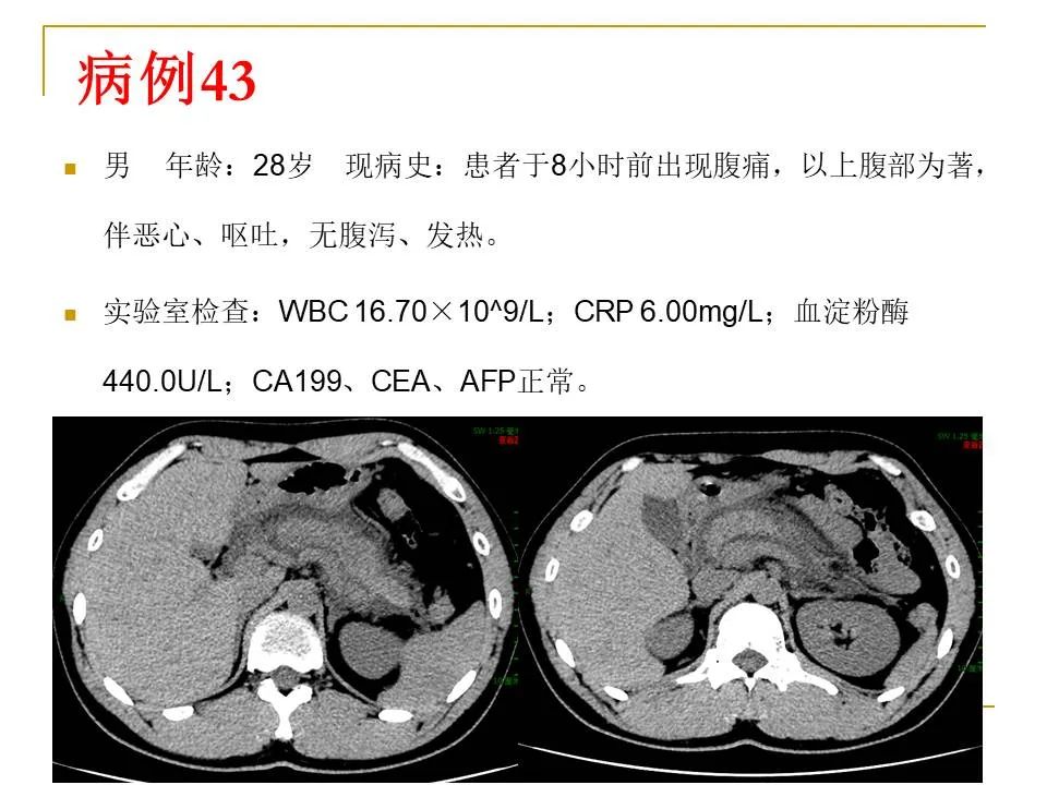 影像PPT - 【PPT】临床专业住院医师结业技能考核-140