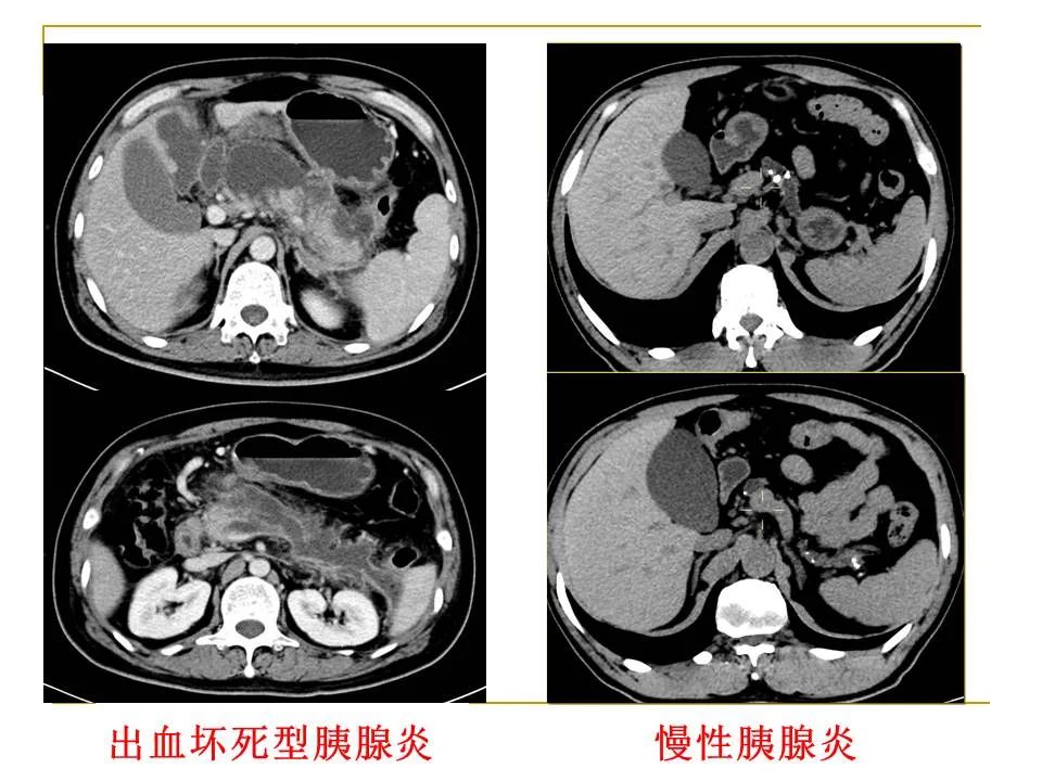 影像PPT - 【PPT】临床专业住院医师结业技能考核-142