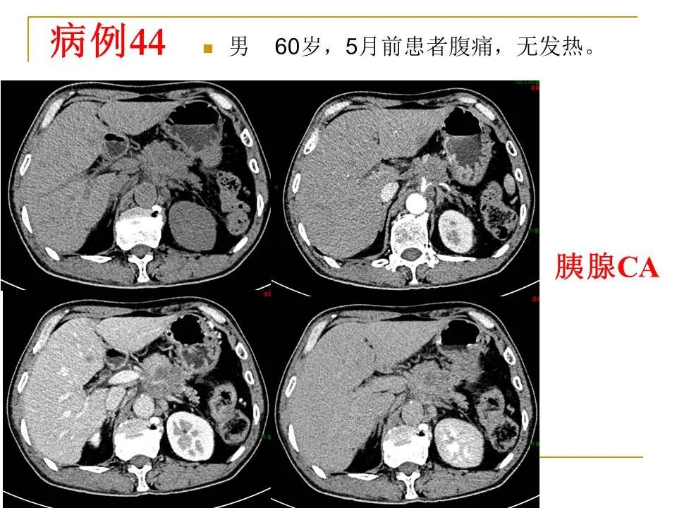 影像PPT - 【PPT】临床专业住院医师结业技能考核-143