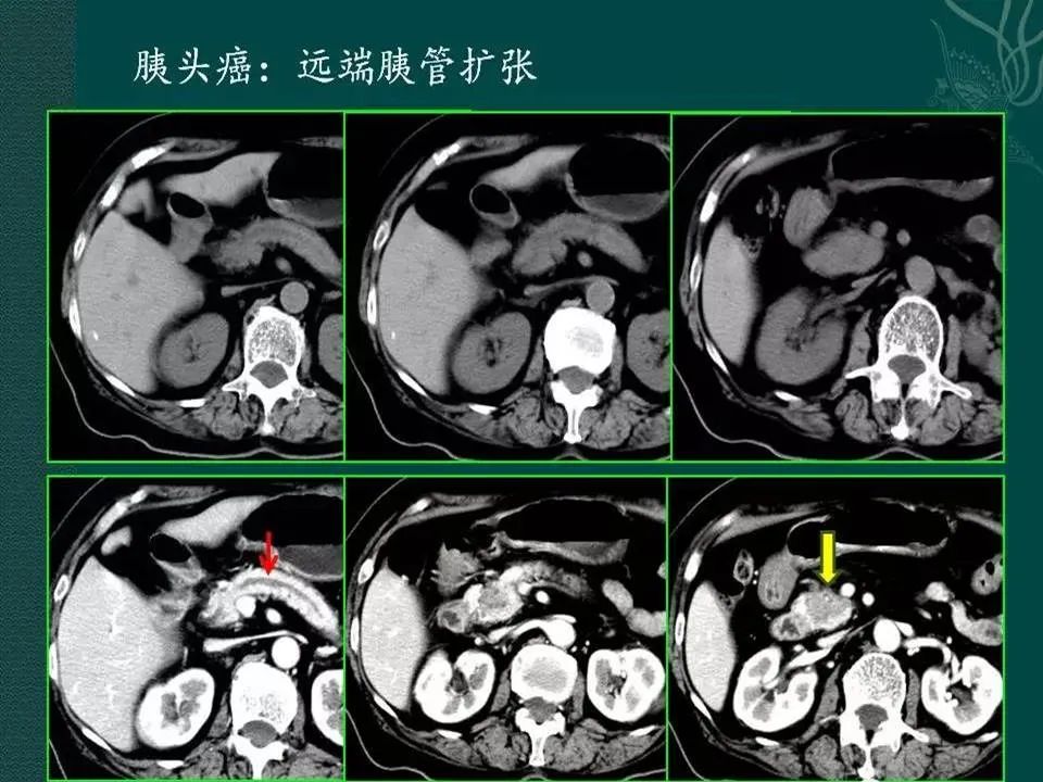 影像PPT - 【PPT】临床专业住院医师结业技能考核-144