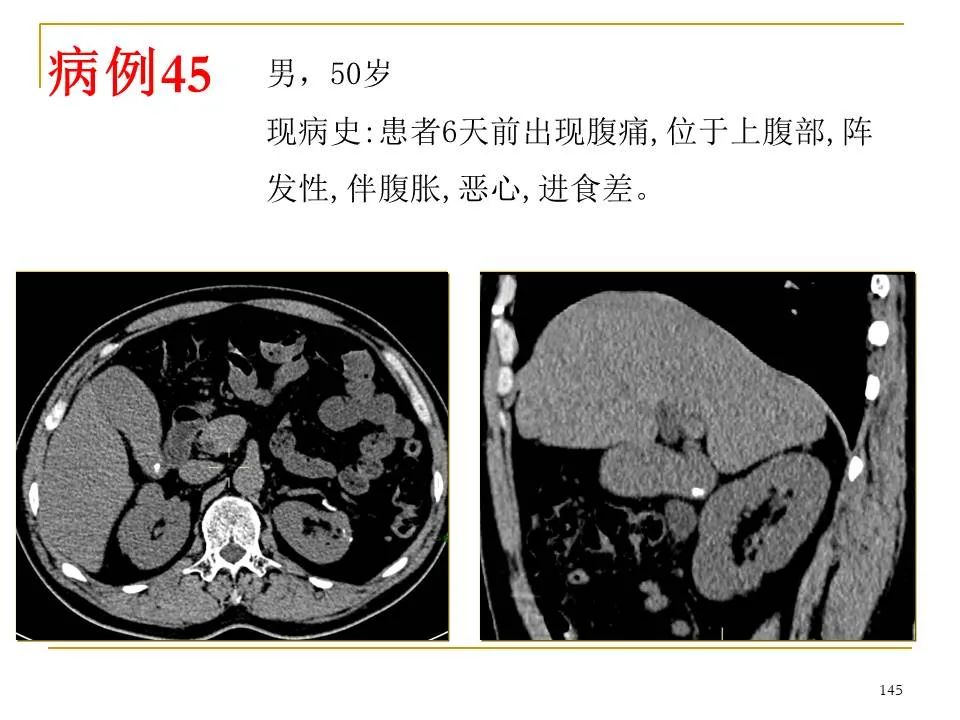 影像PPT - 【PPT】临床专业住院医师结业技能考核-145