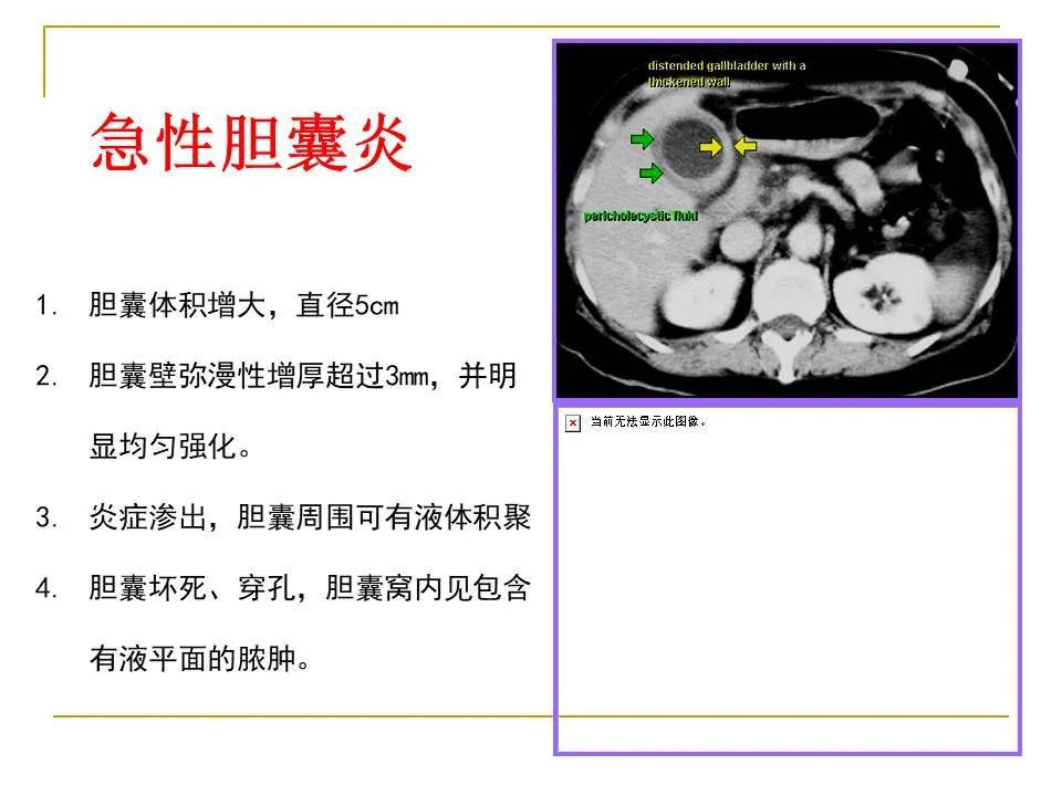 影像PPT - 【PPT】临床专业住院医师结业技能考核-146