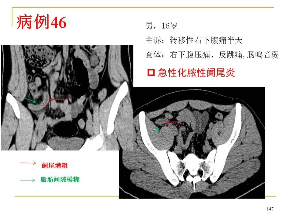 影像PPT - 【PPT】临床专业住院医师结业技能考核-147