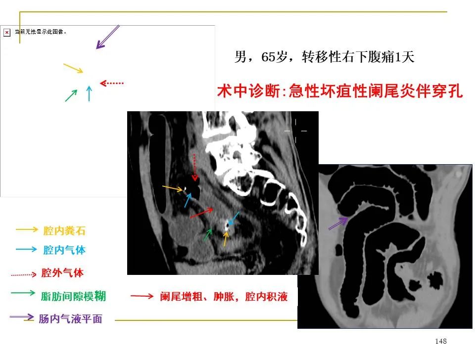 影像PPT - 【PPT】临床专业住院医师结业技能考核-148