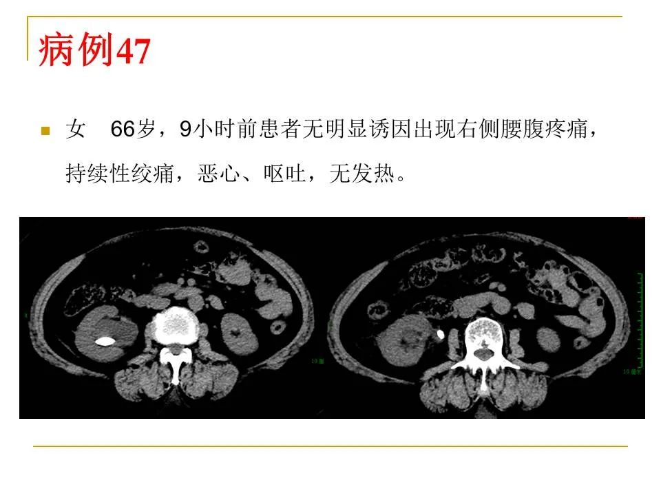 影像PPT - 【PPT】临床专业住院医师结业技能考核-149
