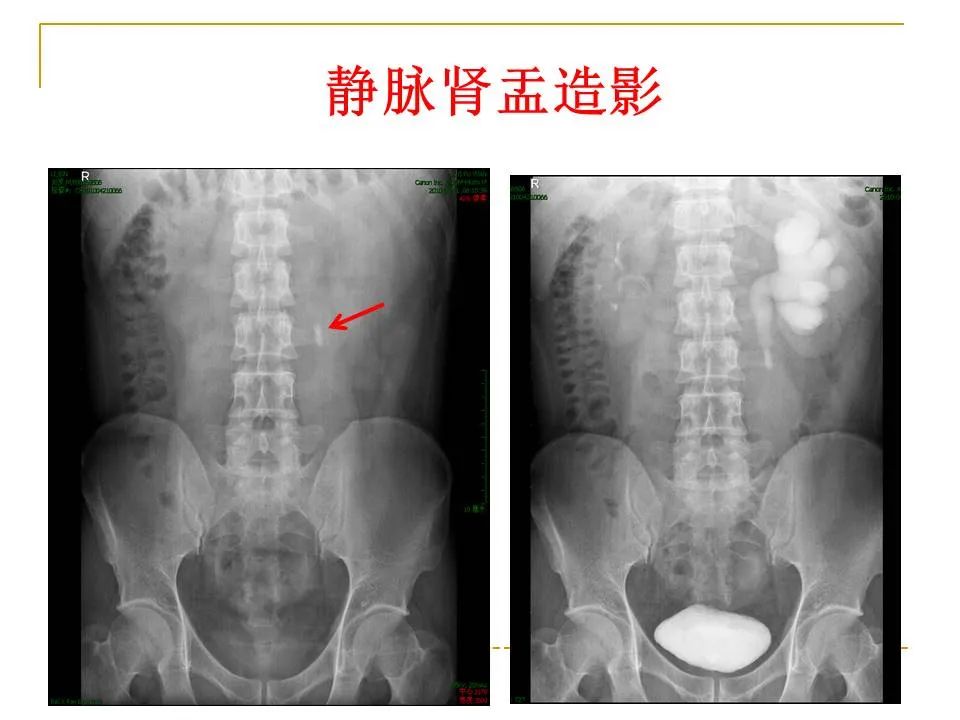 影像PPT - 【PPT】临床专业住院医师结业技能考核-151
