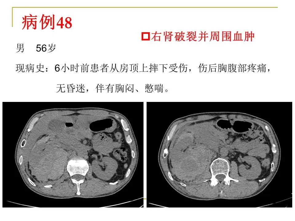 影像PPT - 【PPT】临床专业住院医师结业技能考核-152