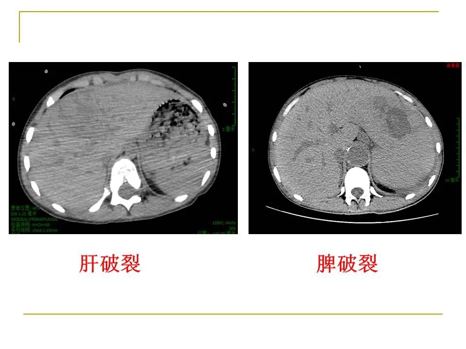影像PPT - 【PPT】临床专业住院医师结业技能考核-153