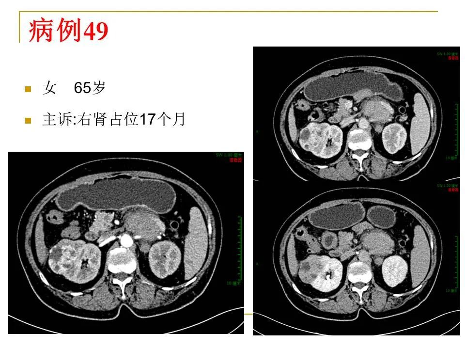 影像PPT - 【PPT】临床专业住院医师结业技能考核-154
