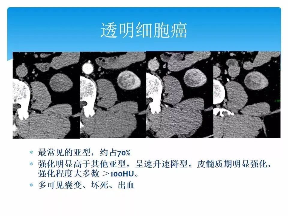 影像PPT - 【PPT】临床专业住院医师结业技能考核-156