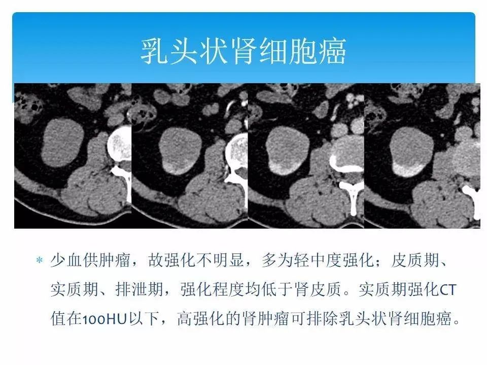 影像PPT - 【PPT】临床专业住院医师结业技能考核-157