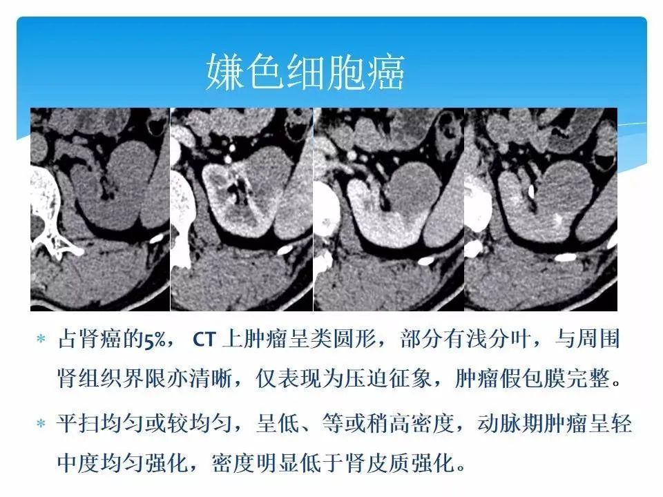 影像PPT - 【PPT】临床专业住院医师结业技能考核-158